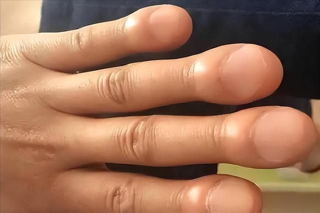 当你以为只是老毛病犯了时,身体可能在发出最后的求救 健康养生